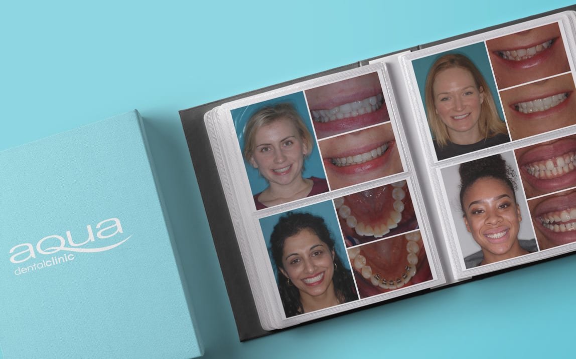 before and after photos