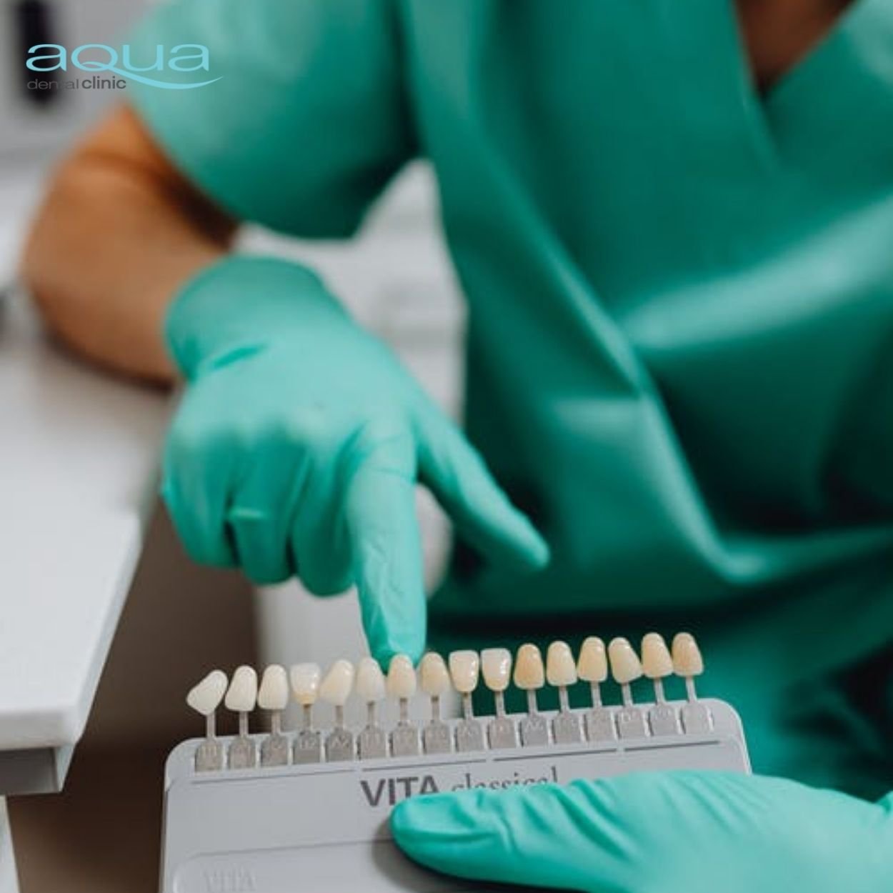 photo of veneer options