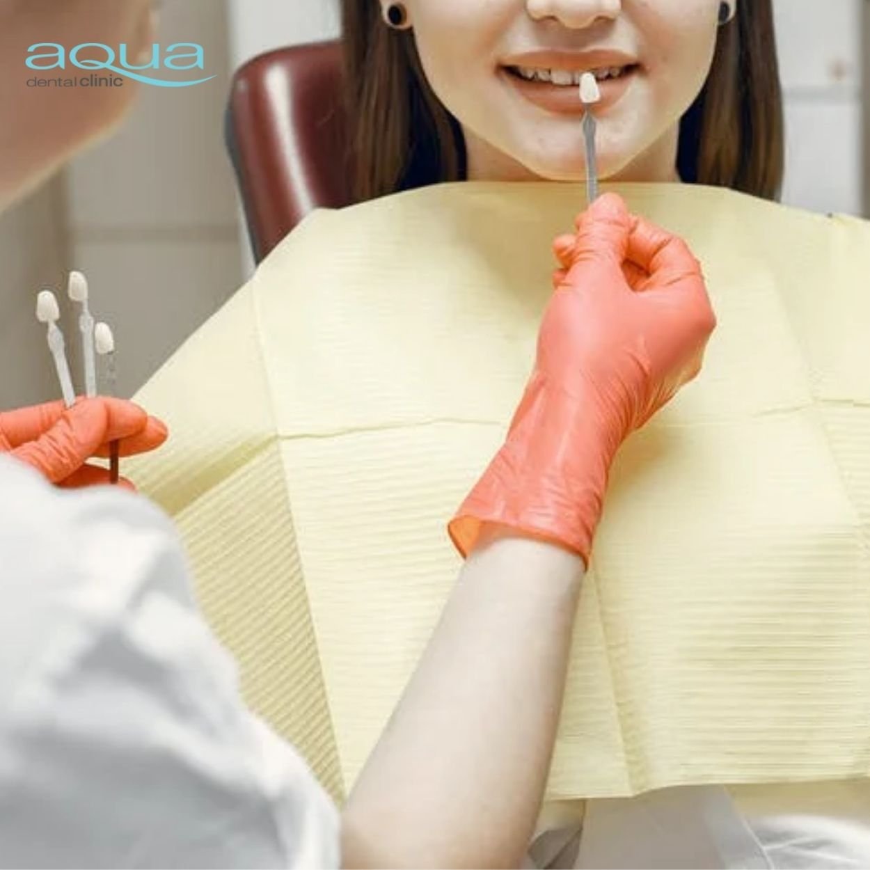 veneer placement image